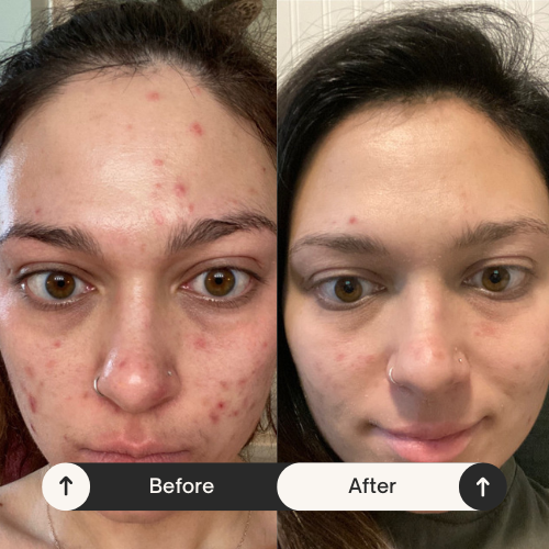 DermaSeal Pro